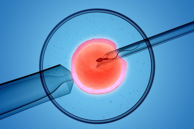 Điều trị bằng huyết tương giàu tiểu cầu có làm tăng tỷ lệ thành công với IVF?