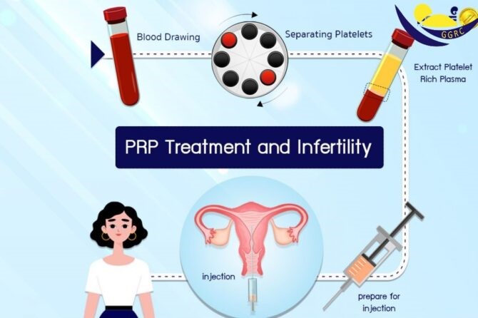 Liệu pháp huyết tương giàu tiểu cầu (PRP) – một cải tiến trong y học sinh sản
